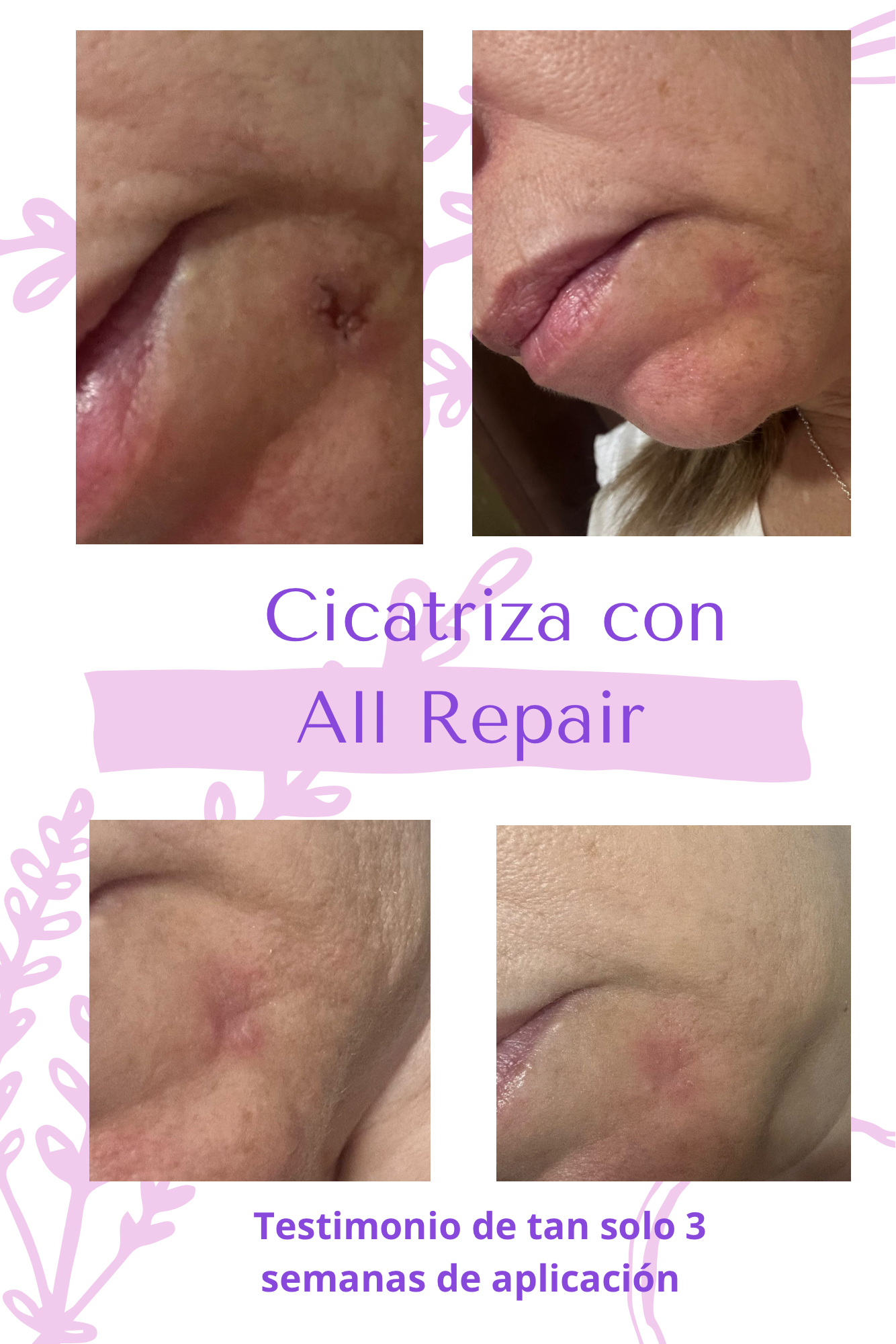 ALL REPAIR   /  Sérum Reparador Humectante y Cicatrizante - Image 3